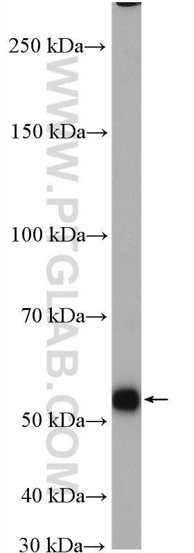 WB analysis of SGC-7901 using 11151-1-AP