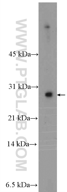 WB analysis of MCF-7 using 26151-1-AP