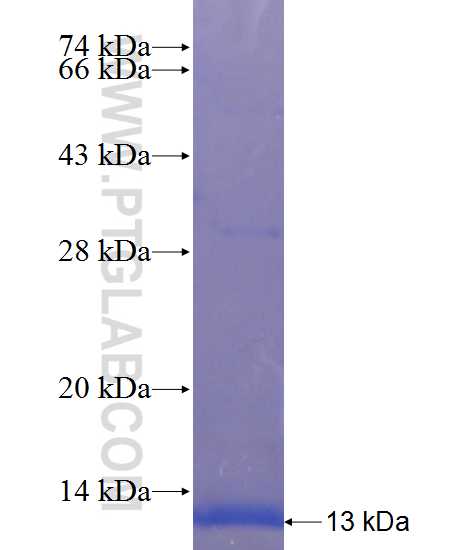 MYEOV2 fusion protein Ag23571 SDS-PAGE MYEOV2 fusion protein Ag23571 SDS-PAGE
