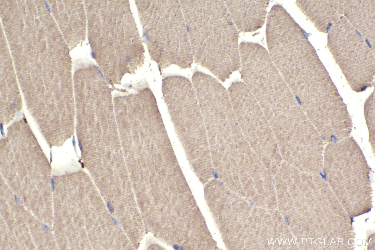 IHC staining of mouse skeletal muscle using 25182-1-AP IHC staining of mouse skeletal muscle using 25182-1-AP
