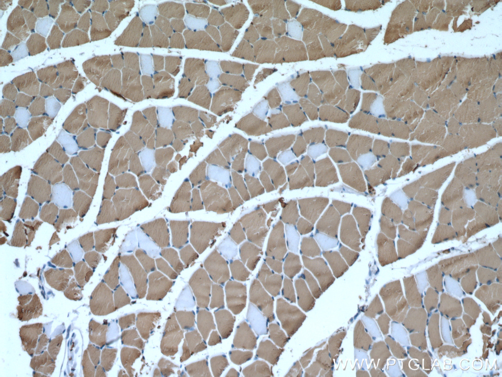 IHC staining of mouse skeletal muscle using 67299-1-Ig