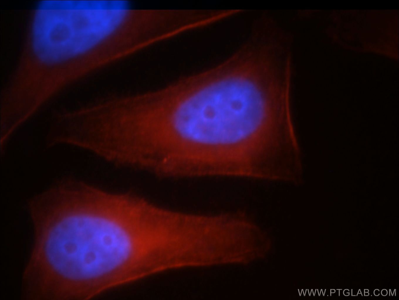 IF Staining of HepG2 using 21403-1-AP