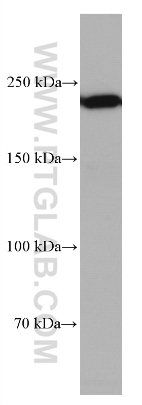 WB analysis of mouse brain using 67243-1-Ig (same clone as 67243-1-PBS)