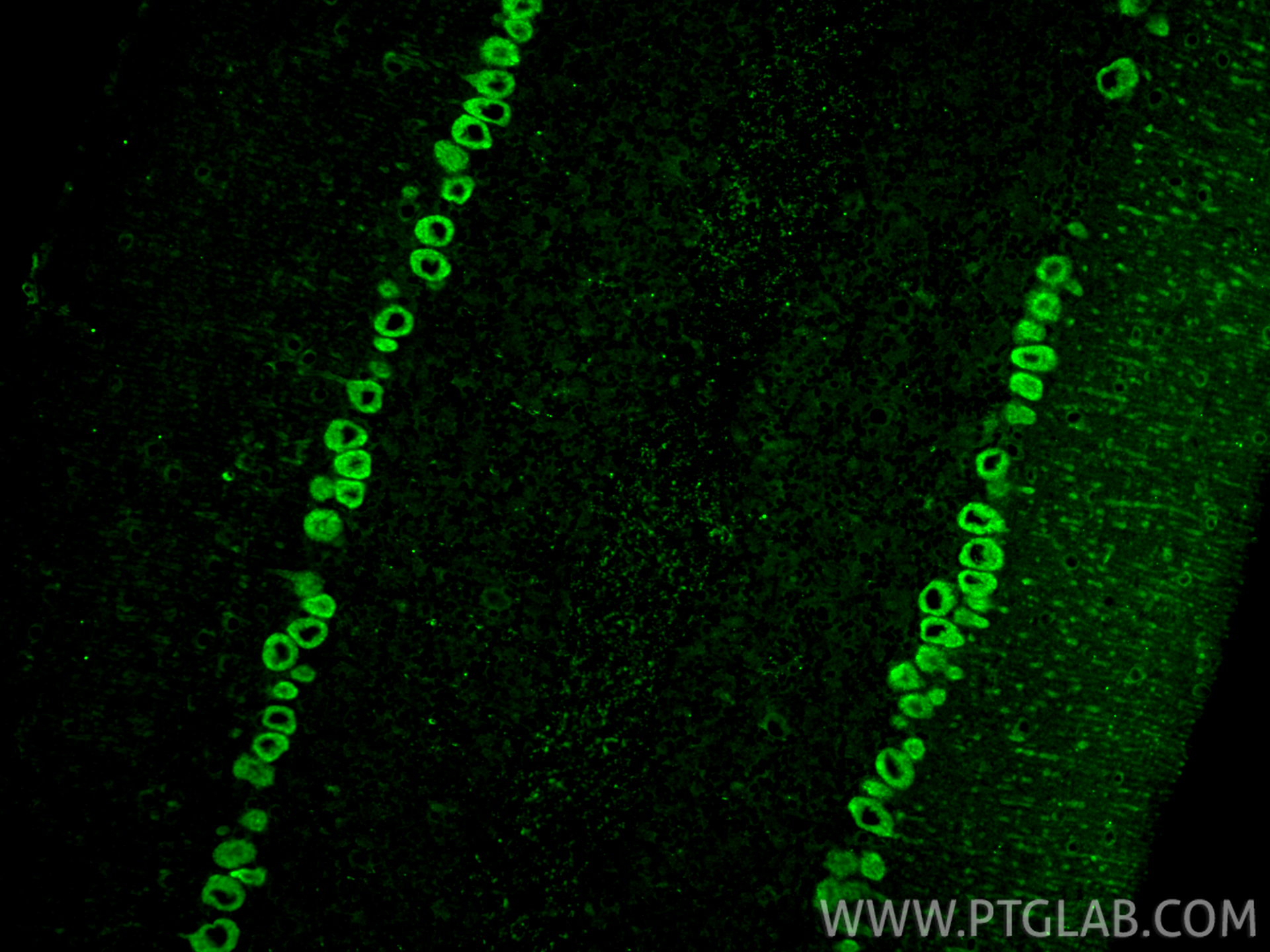 Immunofluorescent analysis of (4% PFA) fixed paraffin-embedded mouse cerebellum tissue using MYH10 antibody (86157-3-RR, Clone: 250791D5 ) at dilution of 1:200 and CoraLite®488-Conjugated Goat Anti-Rabbit IgG(H+L) (<a class='green' href='/productredirect?CatalogNo=SA00013-2' target='_blank'>SA00013-2</a>). Heat mediated antigen retrieval with Tris-EDTA buffer (pH 9.0). IF Staining of mouse cerebellum using 86157-3-RR