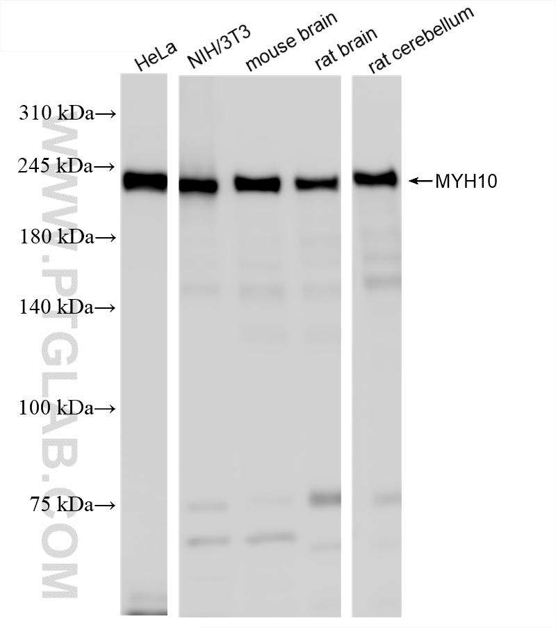 WB analysis using 86157-3-RR (same clone as 86157-3-PBS)