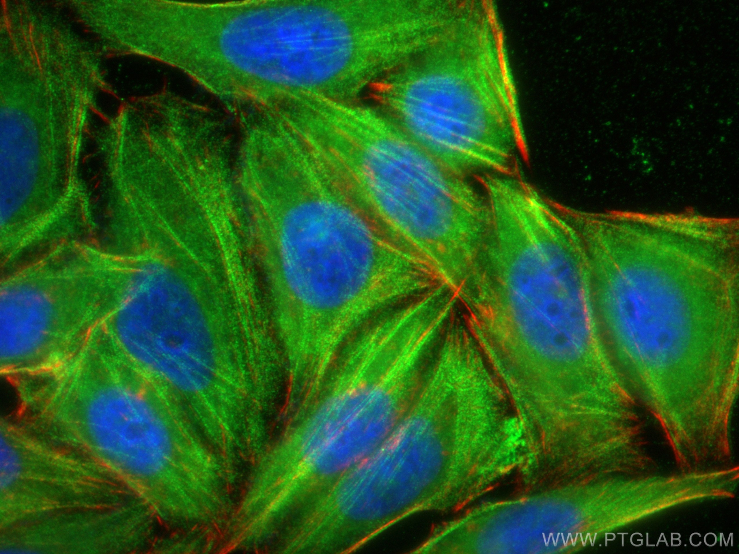 IF Staining of HepG2 using 19673-1-AP