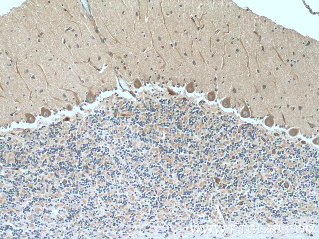 MYH10-Specific Polyclonal antibody