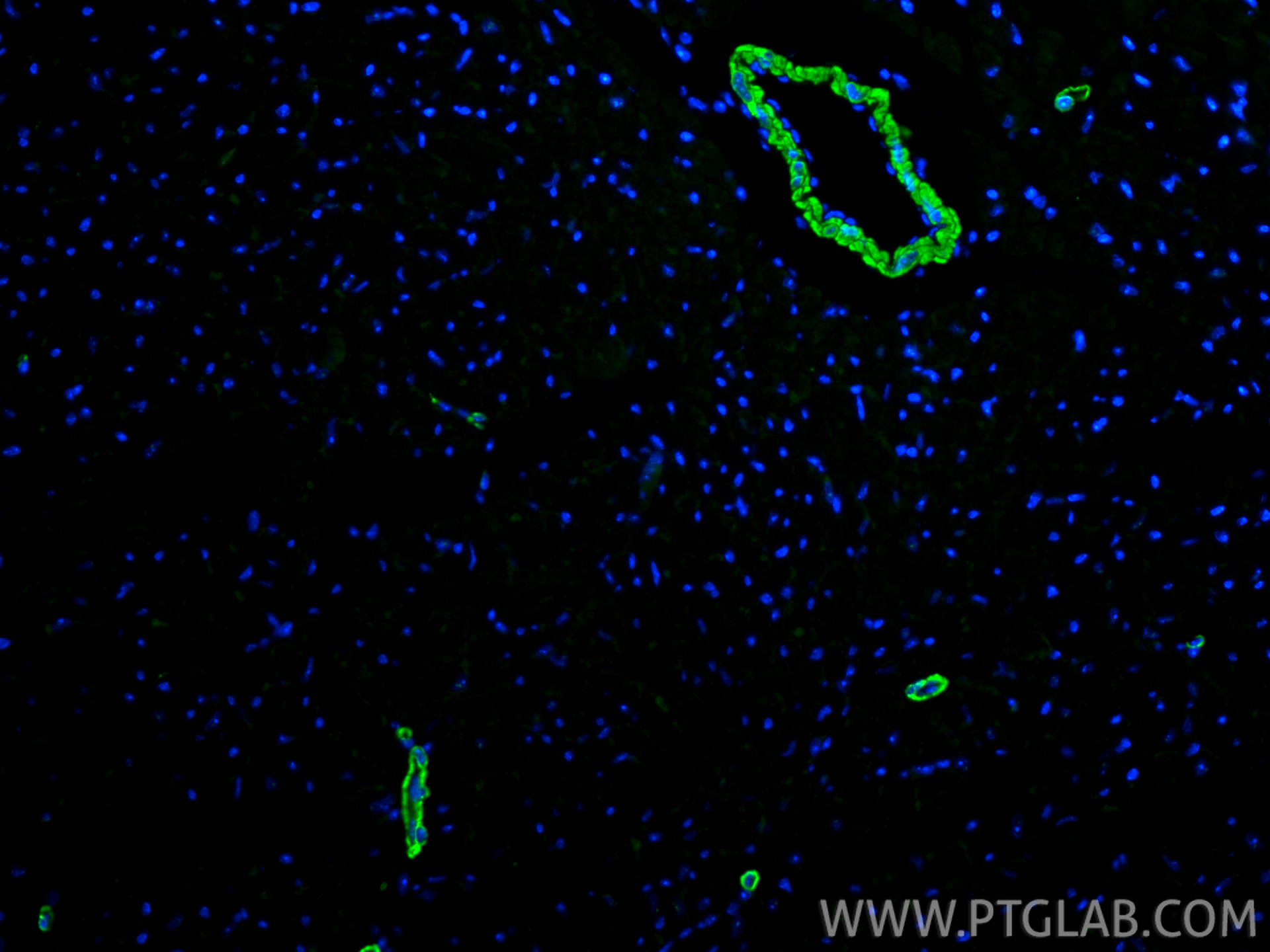 IF Staining of mouse heart using 18569-1-AP IF Staining of mouse heart using 18569-1-AP