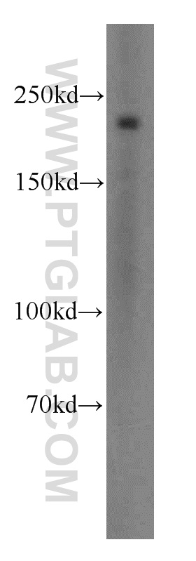 WB analysis of mouse colon using 18569-1-AP