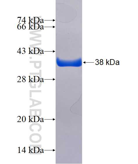MYH11 fusion protein Ag16114 SDS-PAGE