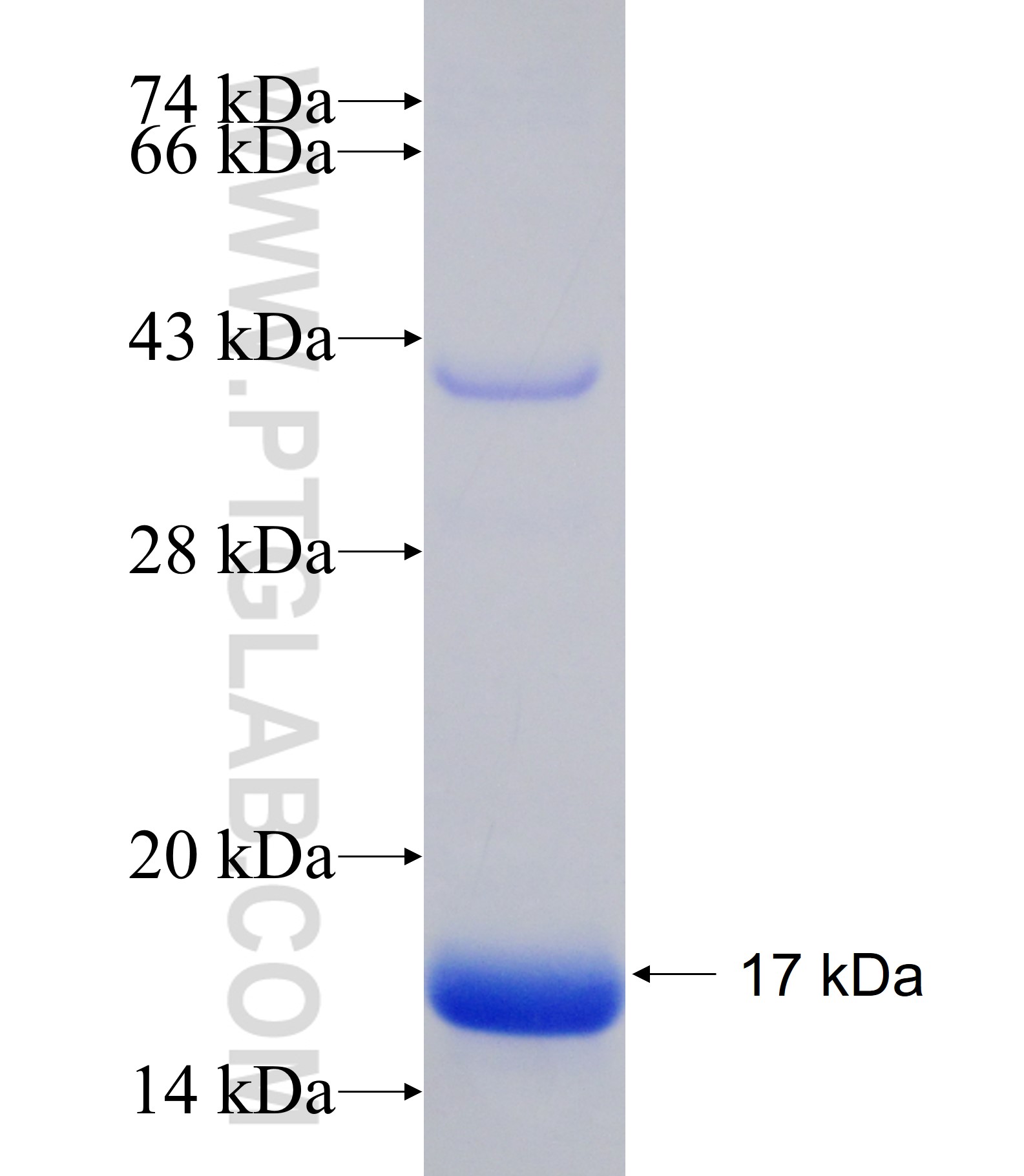 MYH11 fusion protein Ag17068 SDS-PAGE MYH11 fusion protein Ag17068 SDS-PAGE