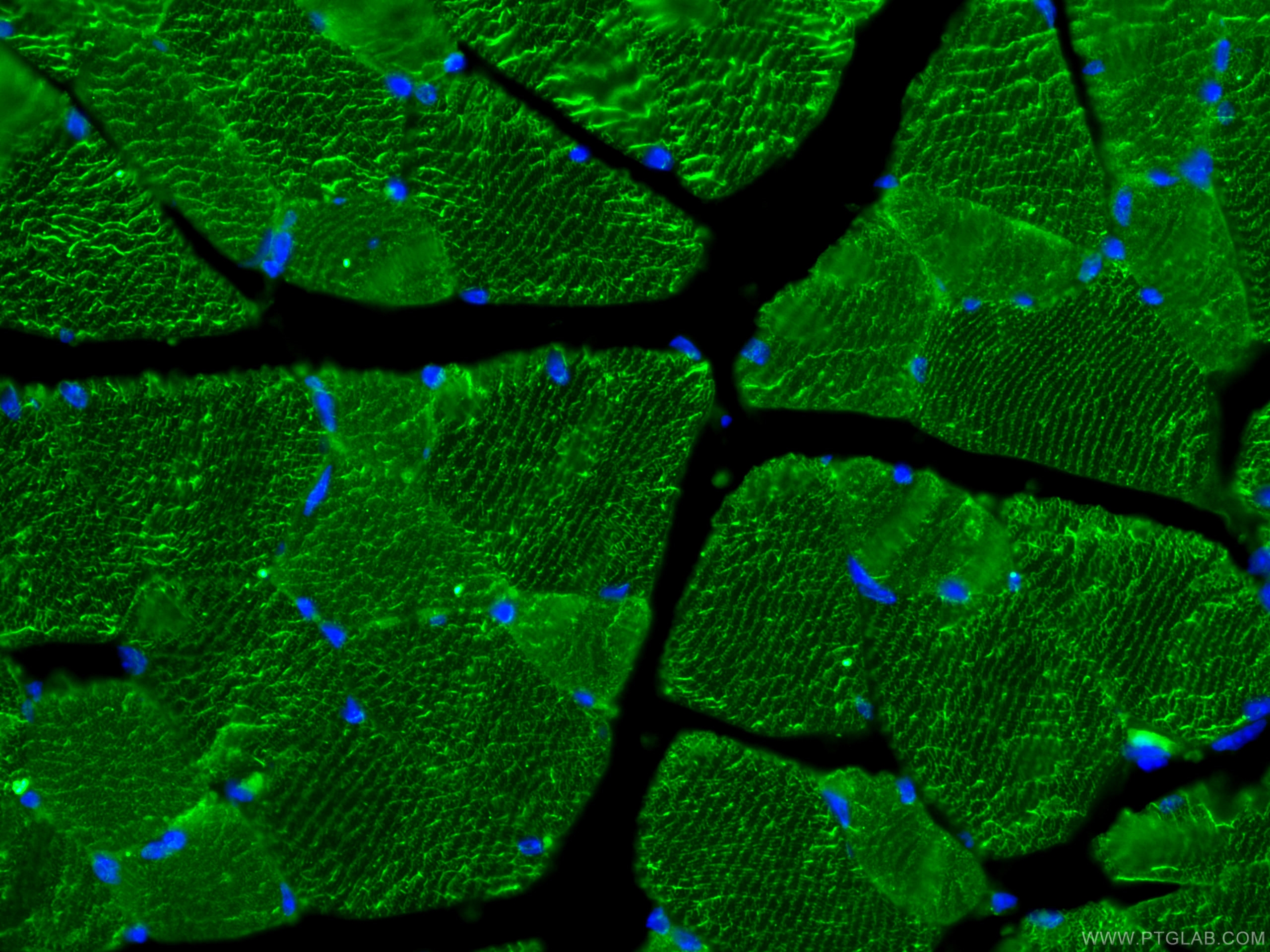 IF Staining of mouse skeletal muscle using 66825-1-Ig (same clone as 66825-1-PBS)