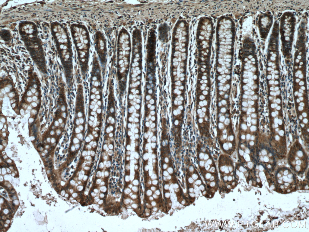 IHC staining of human colon using 66825-1-Ig (same clone as 66825-1-PBS)