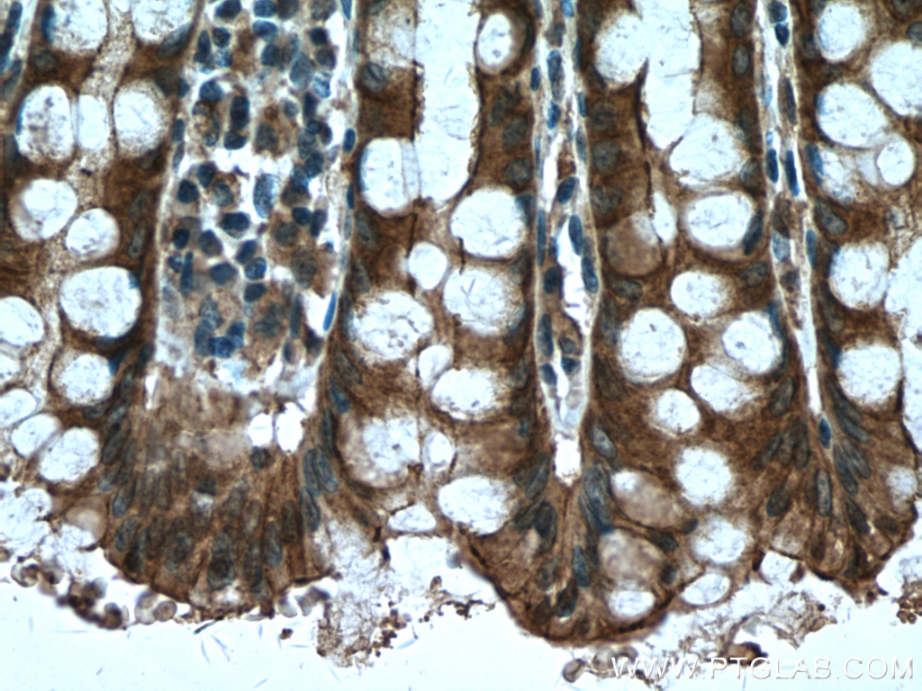 IHC staining of human colon using 66825-1-Ig (same clone as 66825-1-PBS)