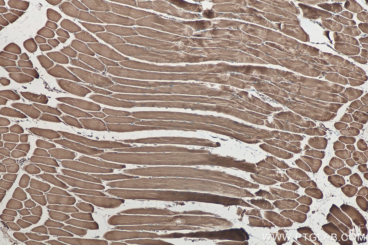 IHC staining of mouse skeletal muscle using 22290-1-AP
