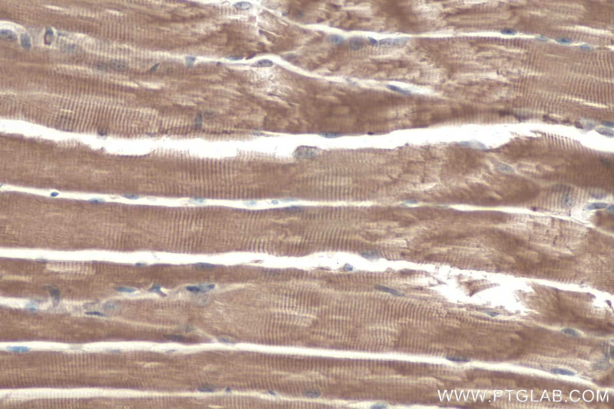 IHC staining of mouse skeletal muscle using 22290-1-AP