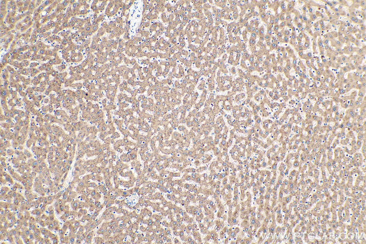 IHC staining of human liver using 22290-1-AP