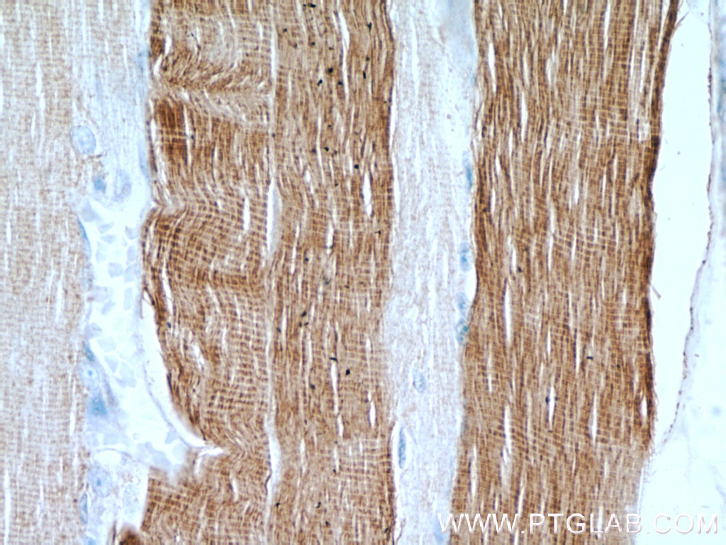 IHC staining of human skeletal muscle using 55069-1-AP