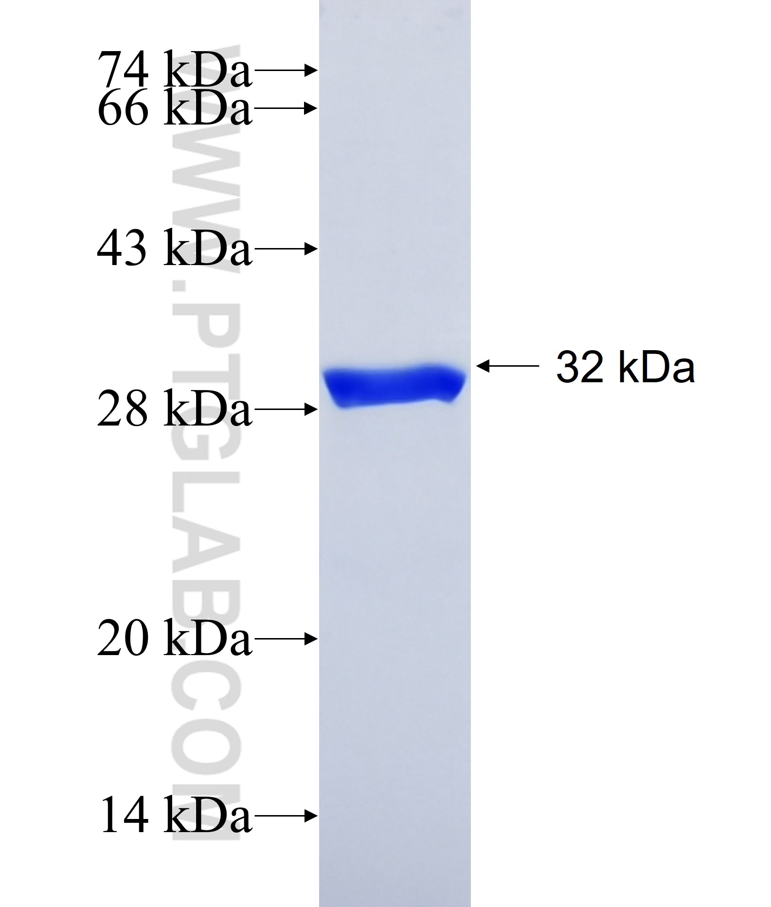 MYH2 fusion protein Ag40617 SDS-PAGE MYH2 fusion protein Ag40617 SDS-PAGE