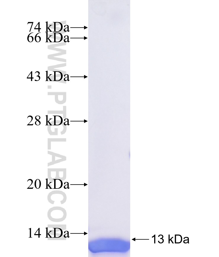 MYH2 fusion protein Ag40633 SDS-PAGE MYH2 fusion protein Ag40633 SDS-PAGE