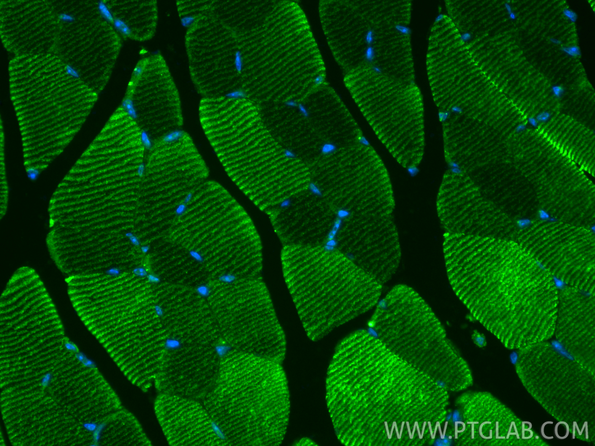 IF Staining of mouse skeletal muscle using 20140-1-AP IF Staining of mouse skeletal muscle using 20140-1-AP