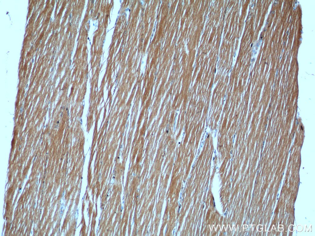 IHC staining of human skeletal muscle using 20140-1-AP
