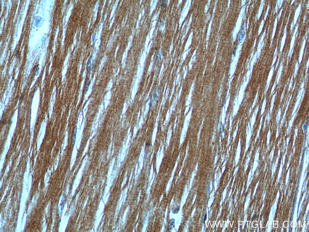 IHC staining of human skeletal muscle using 20140-1-AP