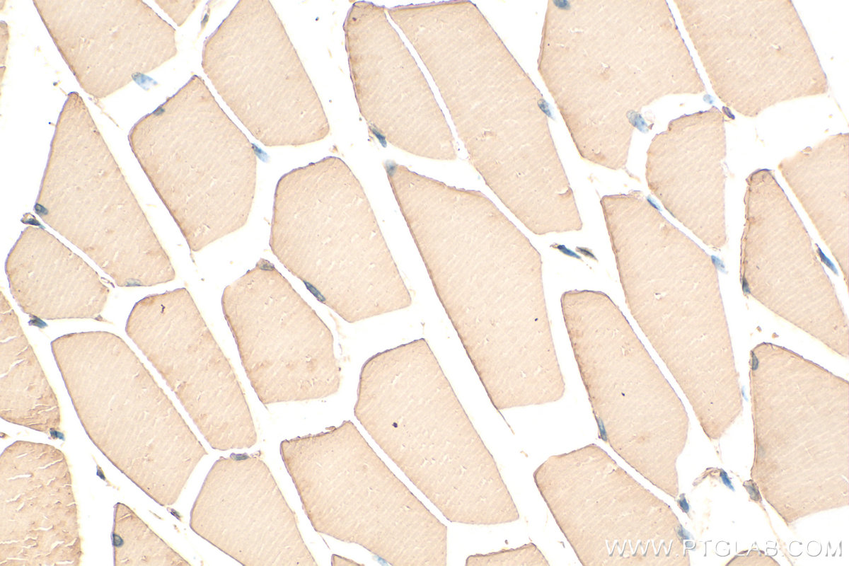 Immunohistochemical analysis of paraffin-embedded mouse skeletal muscle tissue slide using 20140-1-AP (MYH4-Specific antibody) at dilution of 1:100 (under 40x lens). Heat mediated antigen retrieval with Tris-EDTA buffer (pH 9.0). IHC staining of mouse skeletal muscle using 20140-1-AP