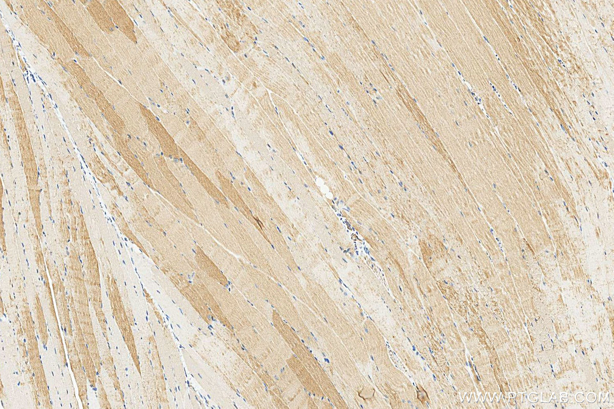 IHC staining of mouse skeletal muscle using 20140-1-AP IHC staining of mouse skeletal muscle using 20140-1-AP