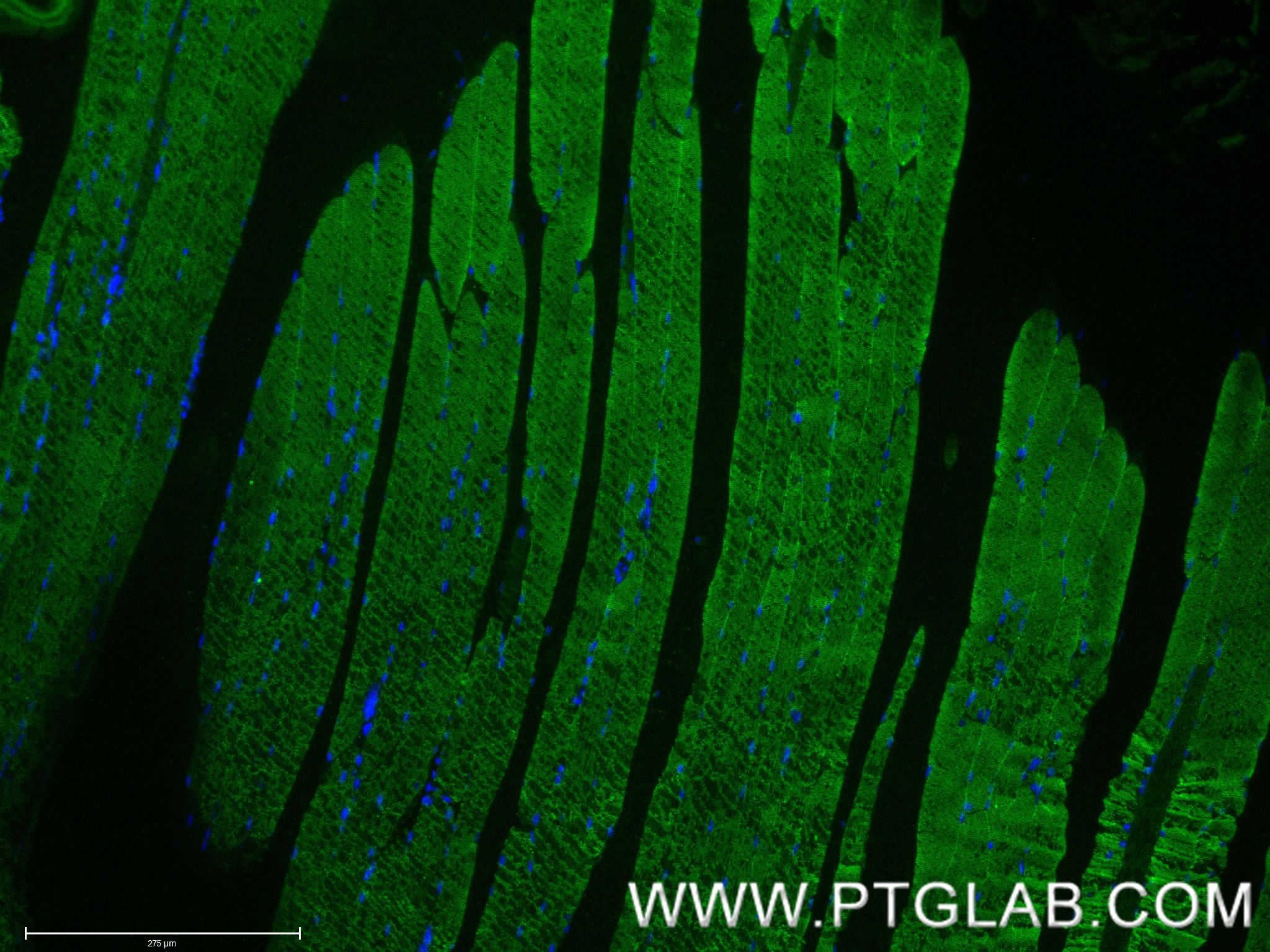 Immunofluorescent analysis of (4% PFA) fixed paraffin-embedded mouse skeletal muscle tissue using MYH4-Specific antibody (85376-1-RR, Clone: 242795B2 ) at dilution of 1:400 and CoraLite®488-Conjugated Goat Anti-Rabbit IgG(H+L) (<a class='green' href='/productredirect?CatalogNo=SA00013-2' target='_blank'>SA00013-2</a>). Heat mediated antigen retrieval with Tris-EDTA buffer (pH 9.0). IF Staining of mouse skeletal muscle using 85376-1-RR