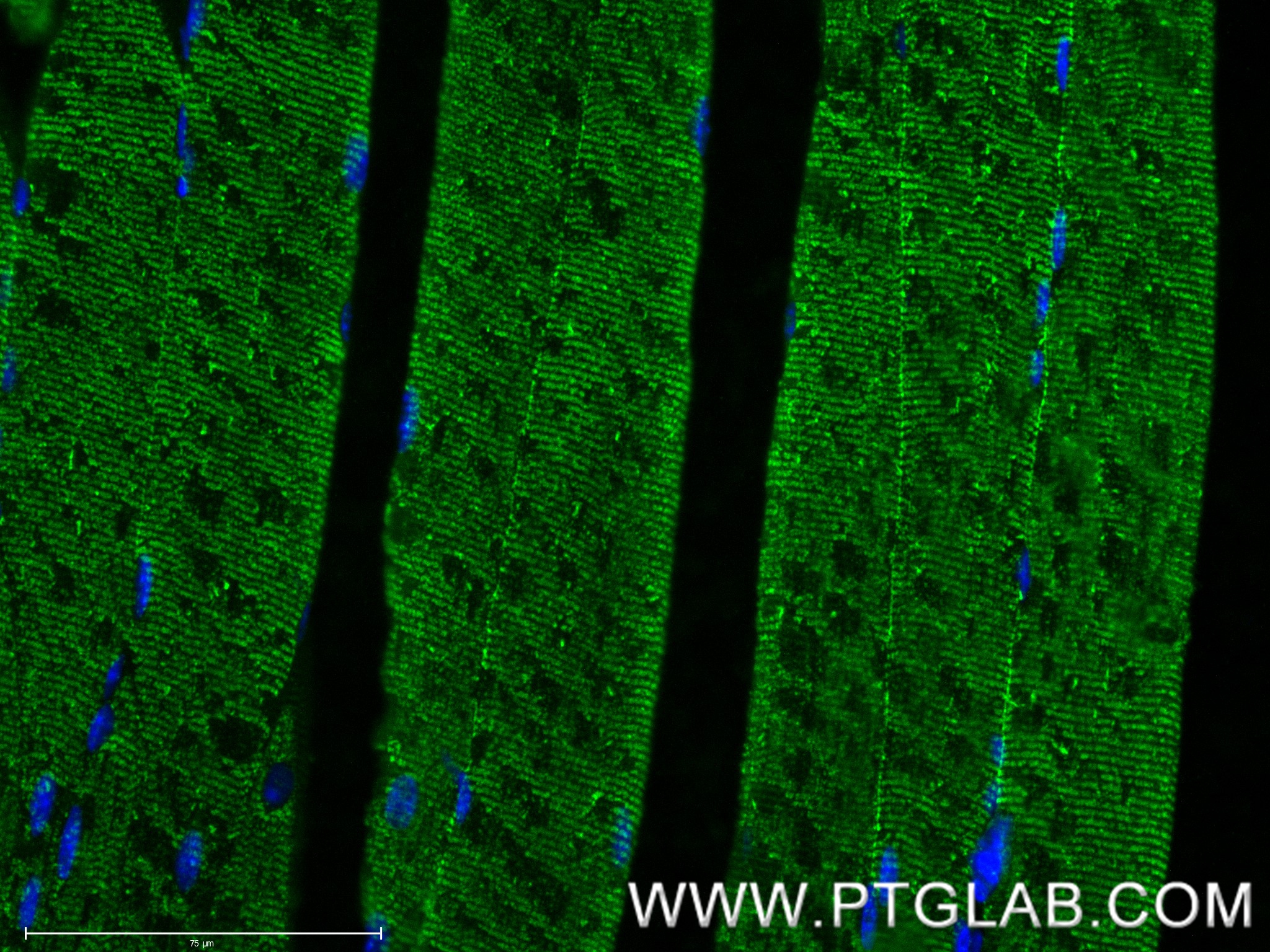 Immunofluorescent analysis of (4% PFA) fixed paraffin-embedded mouse skeletal muscle tissue using MYH4-Specific antibody (85376-1-RR, Clone: 242795B2 ) at dilution of 1:400 and CoraLite®488-Conjugated Goat Anti-Rabbit IgG(H+L) (<a class='green' href='/productredirect?CatalogNo=SA00013-2' target='_blank'>SA00013-2</a>). Heat mediated antigen retrieval with Tris-EDTA buffer (pH 9.0). IF Staining of mouse skeletal muscle using 85376-1-RR