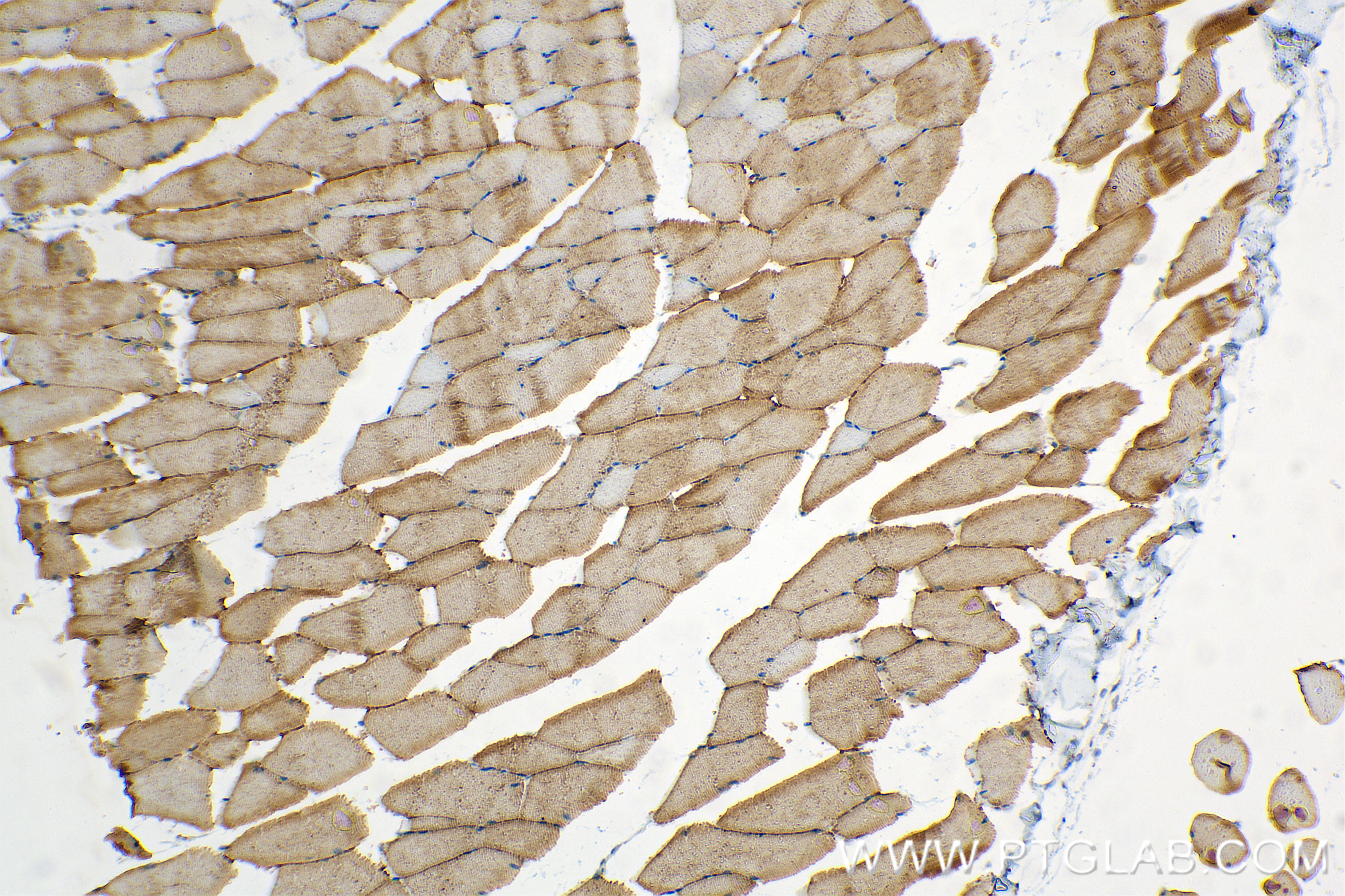 IHC staining of mouse skeletal muscle using 85376-1-RR