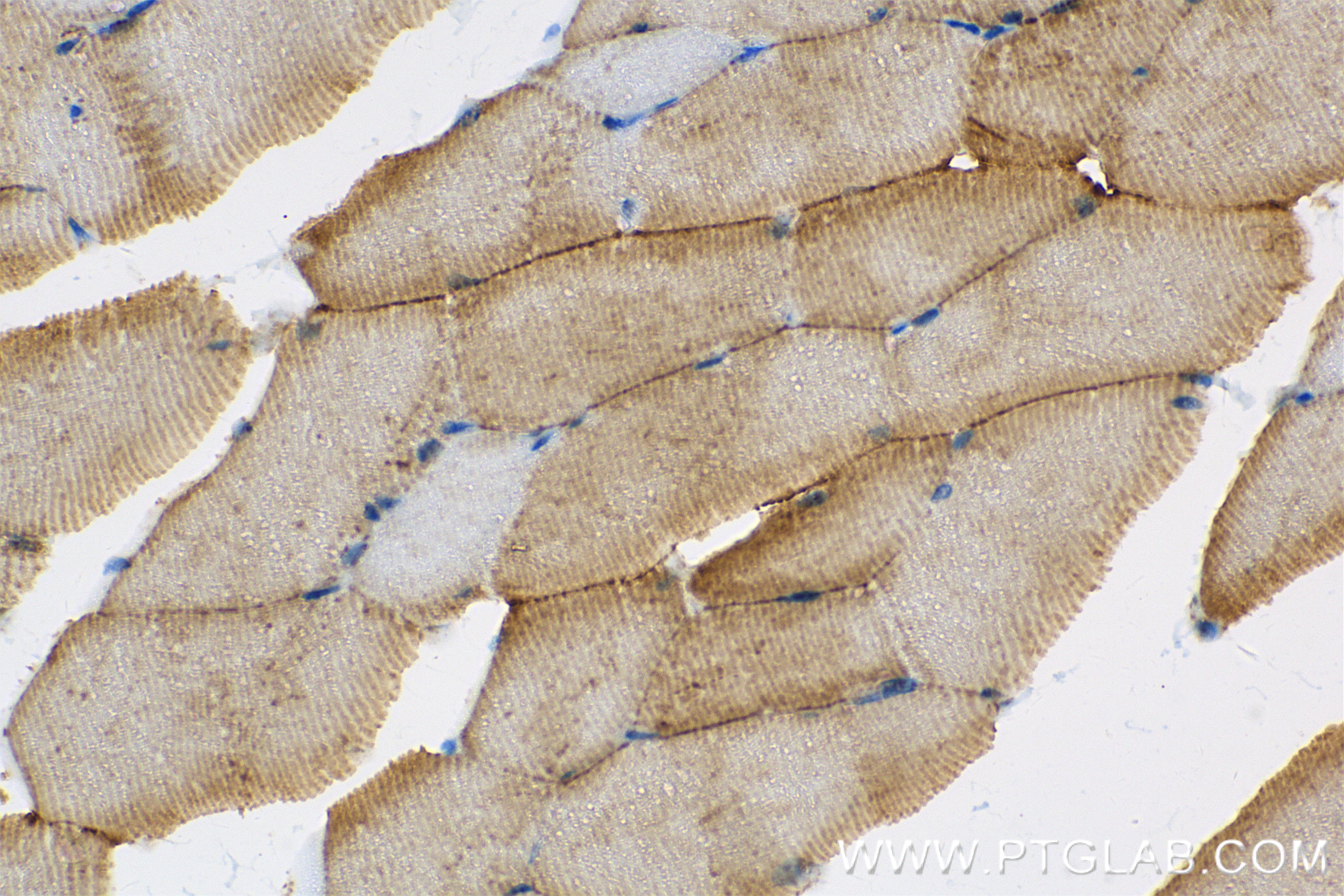 IHC staining of mouse skeletal muscle using 85376-1-RR
