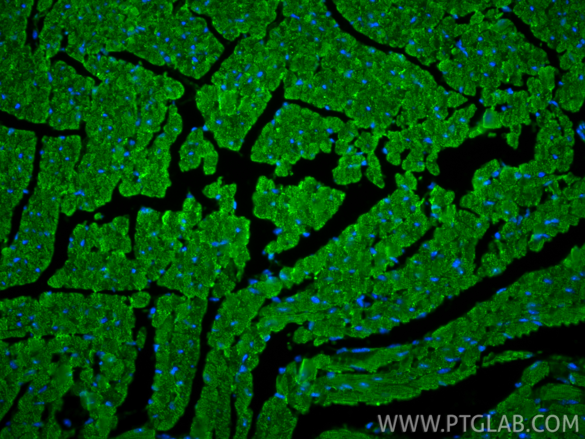 IF Staining of mouse heart using 22281-1-AP IF Staining of mouse heart using 22281-1-AP
