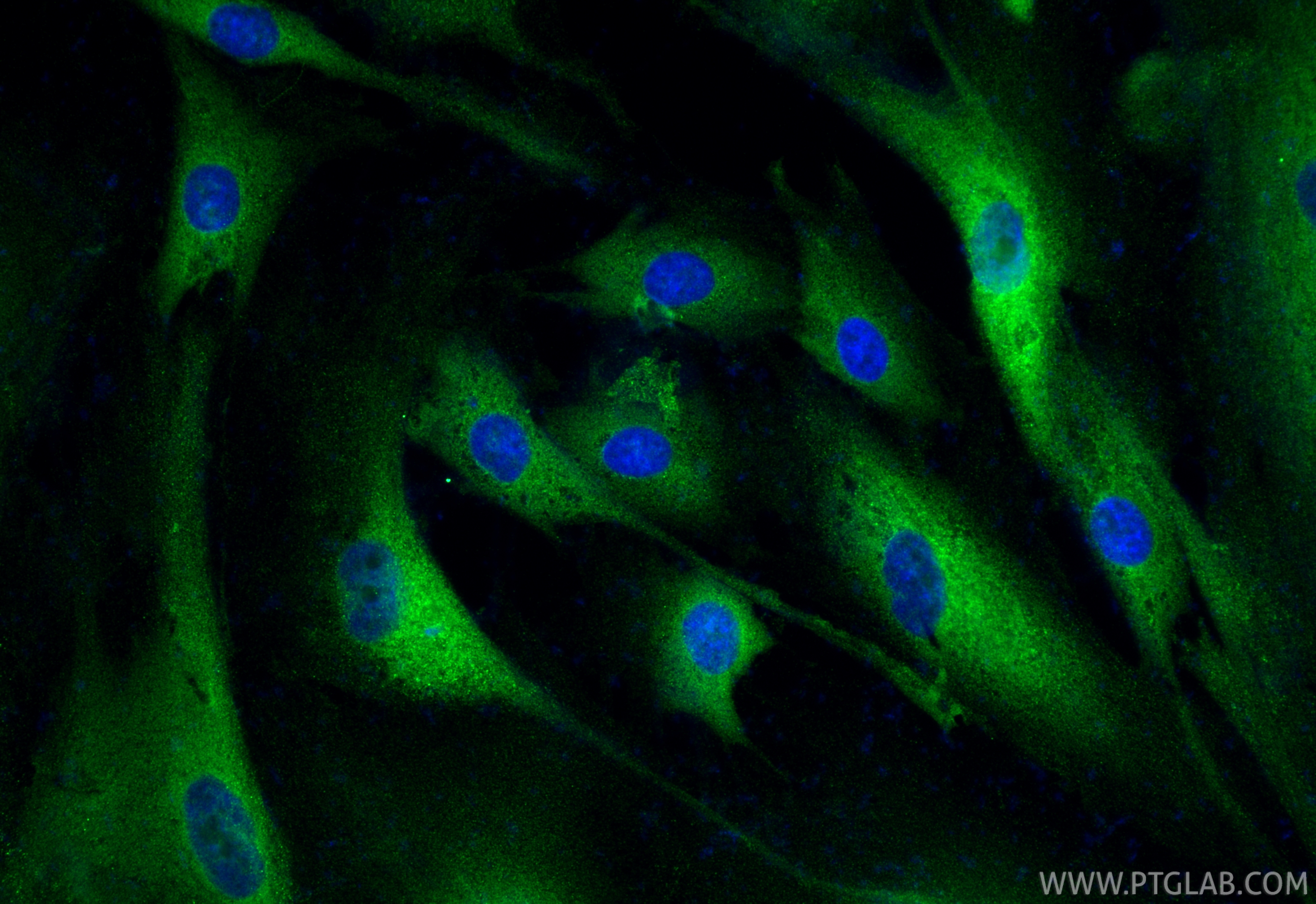 IF Staining of HSkMC using 22281-1-AP IF Staining of HSkMC using 22281-1-AP