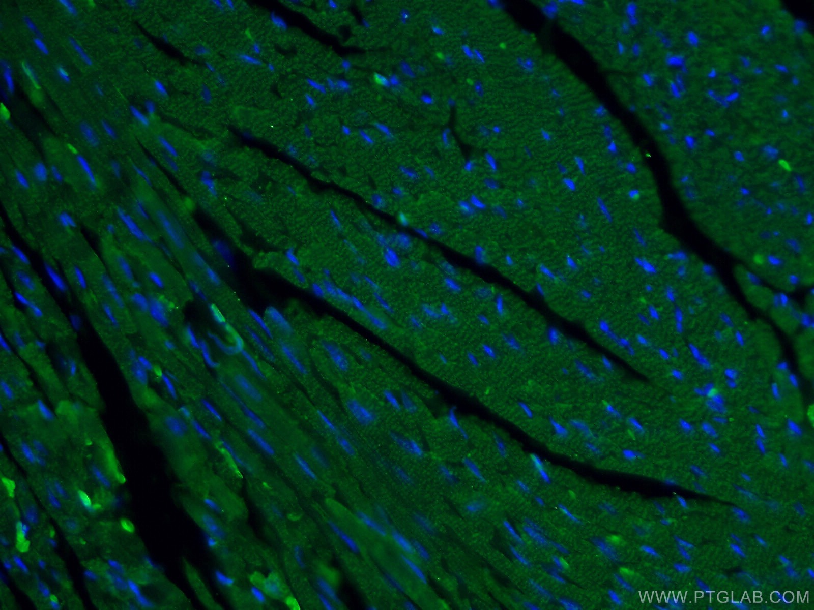 IF Staining of mouse heart using 22281-1-AP