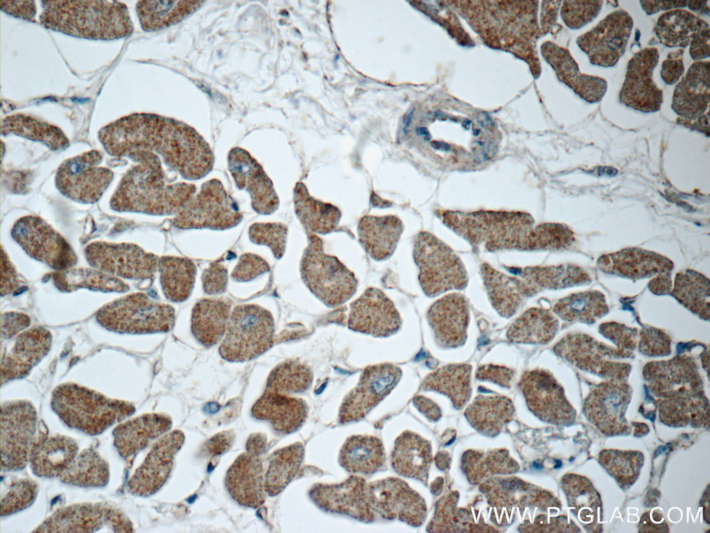 IHC staining of human heart using 22281-1-AP