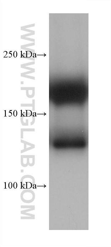 WB analysis of rat heart using 68461-1-Ig (same clone as 68461-1-PBS)