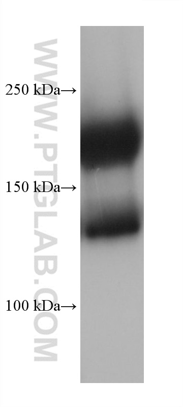 WB analysis of mouse heart using 68461-1-Ig