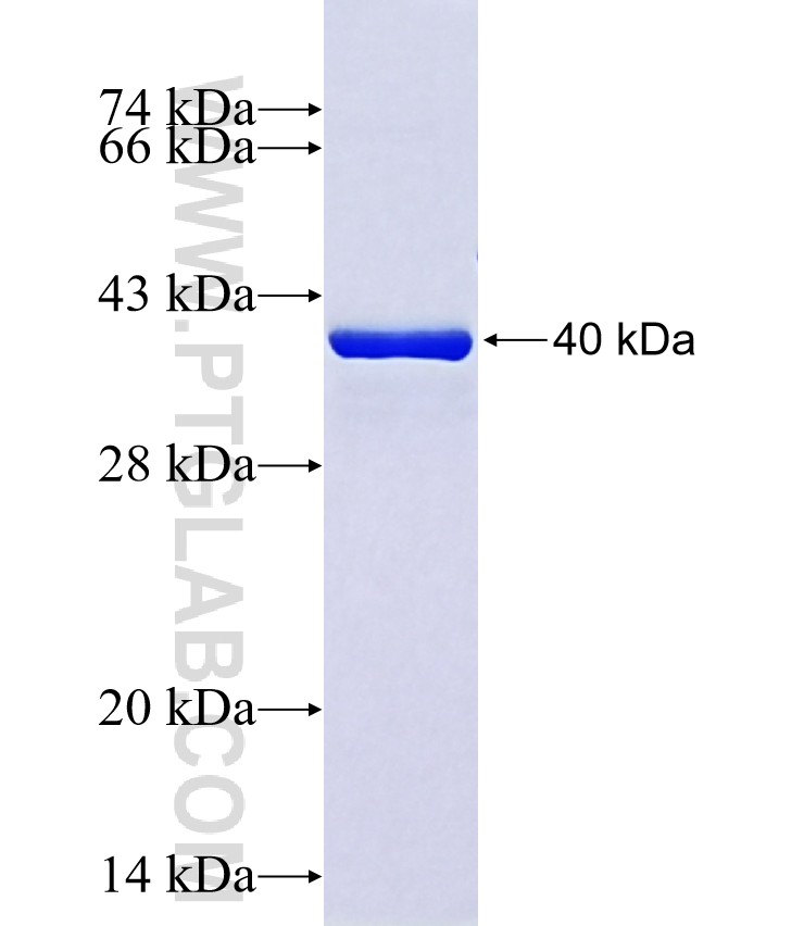 MYH6 fusion protein Ag40981 SDS-PAGE MYH6 fusion protein Ag40981 SDS-PAGE