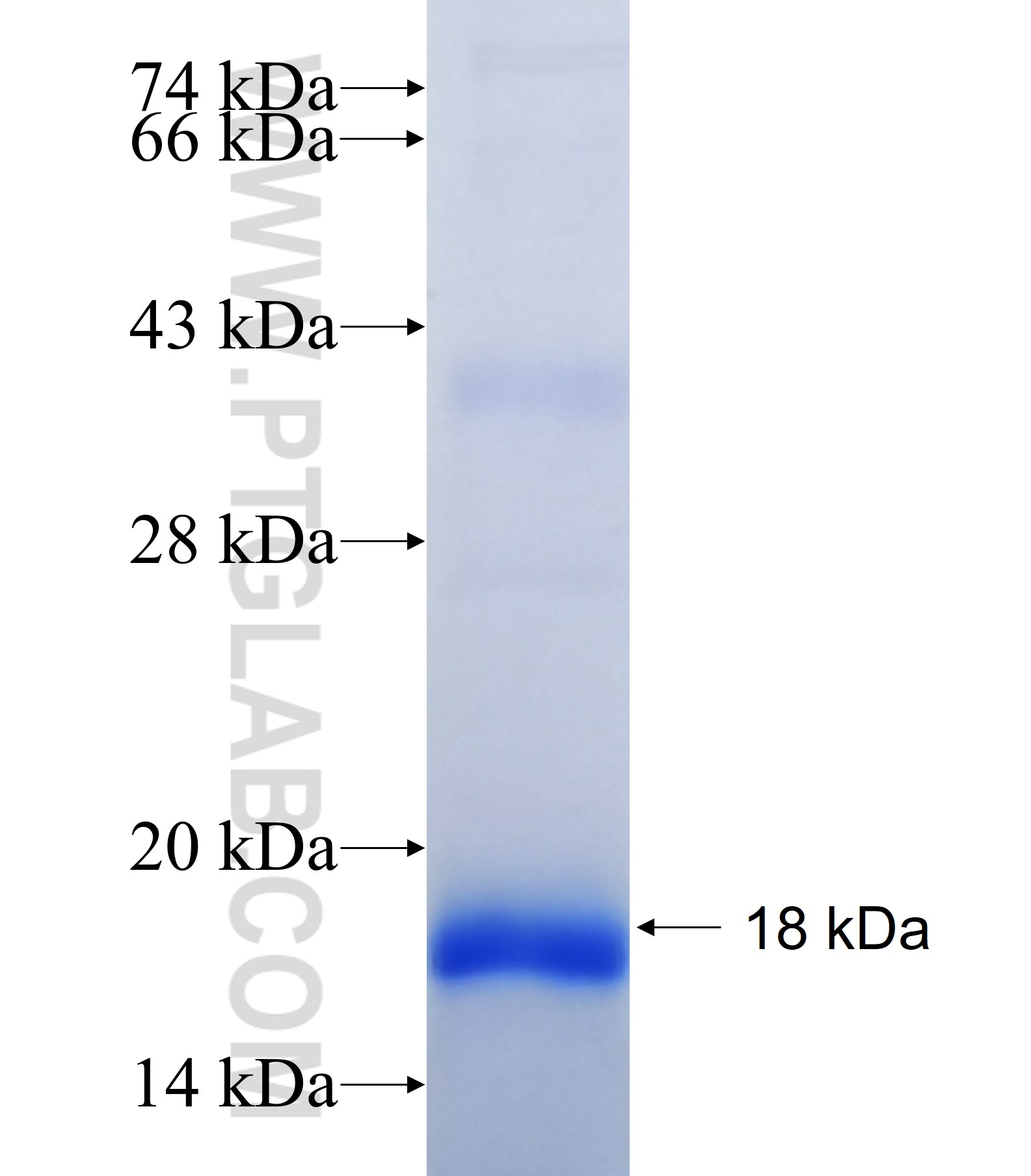 MYH6 fusion protein Ag41028 SDS-PAGE MYH6 fusion protein Ag41028 SDS-PAGE