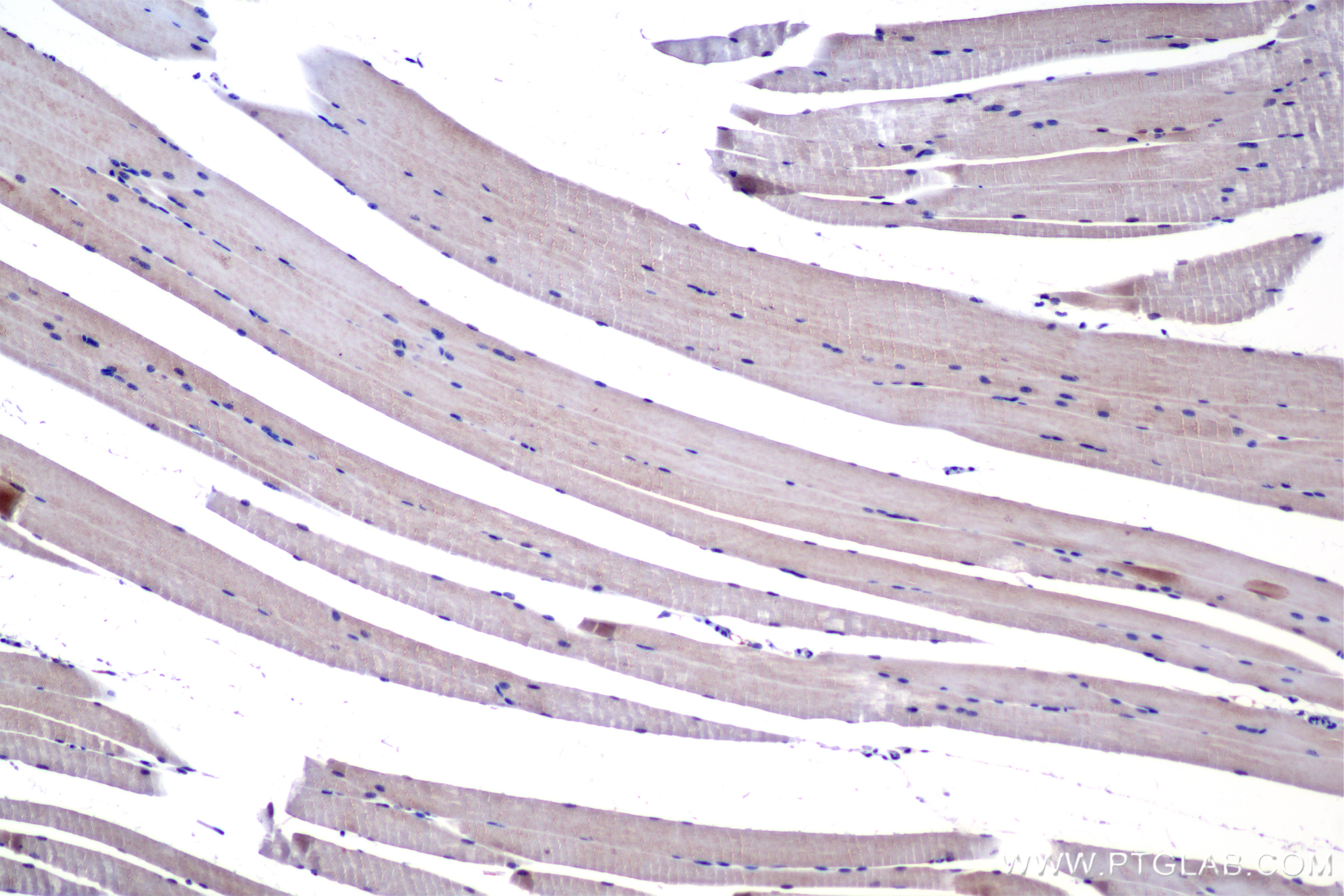 Immunohistochemical analysis of paraffin-embedded mouse skeletal muscle tissue slide using 85322-1-RR (MYH7 antibody) at dilution of 1:800 (under 10x lens). Heat mediated antigen retrieval with Tris-EDTA buffer (pH 9.0). IHC staining of mouse skeletal muscle using 85322-1-RR