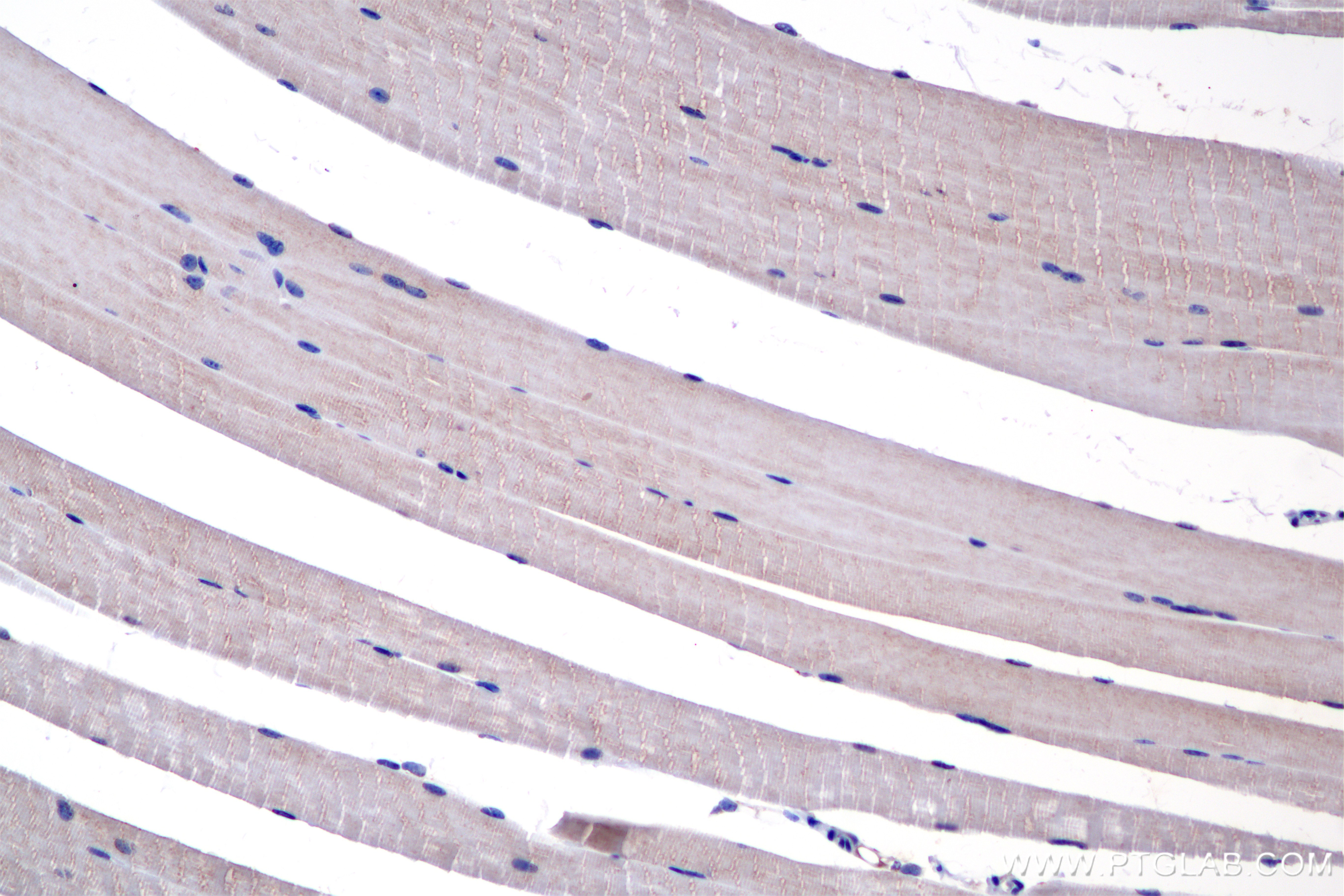 Immunohistochemical analysis of paraffin-embedded mouse skeletal muscle tissue slide using 85322-1-RR (MYH7 antibody) at dilution of 1:800 (under 20x lens). Heat mediated antigen retrieval with Tris-EDTA buffer (pH 9.0). IHC staining of mouse skeletal muscle using 85322-1-RR