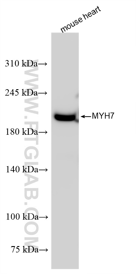 WB analysis of mouse heart using 85322-1-RR