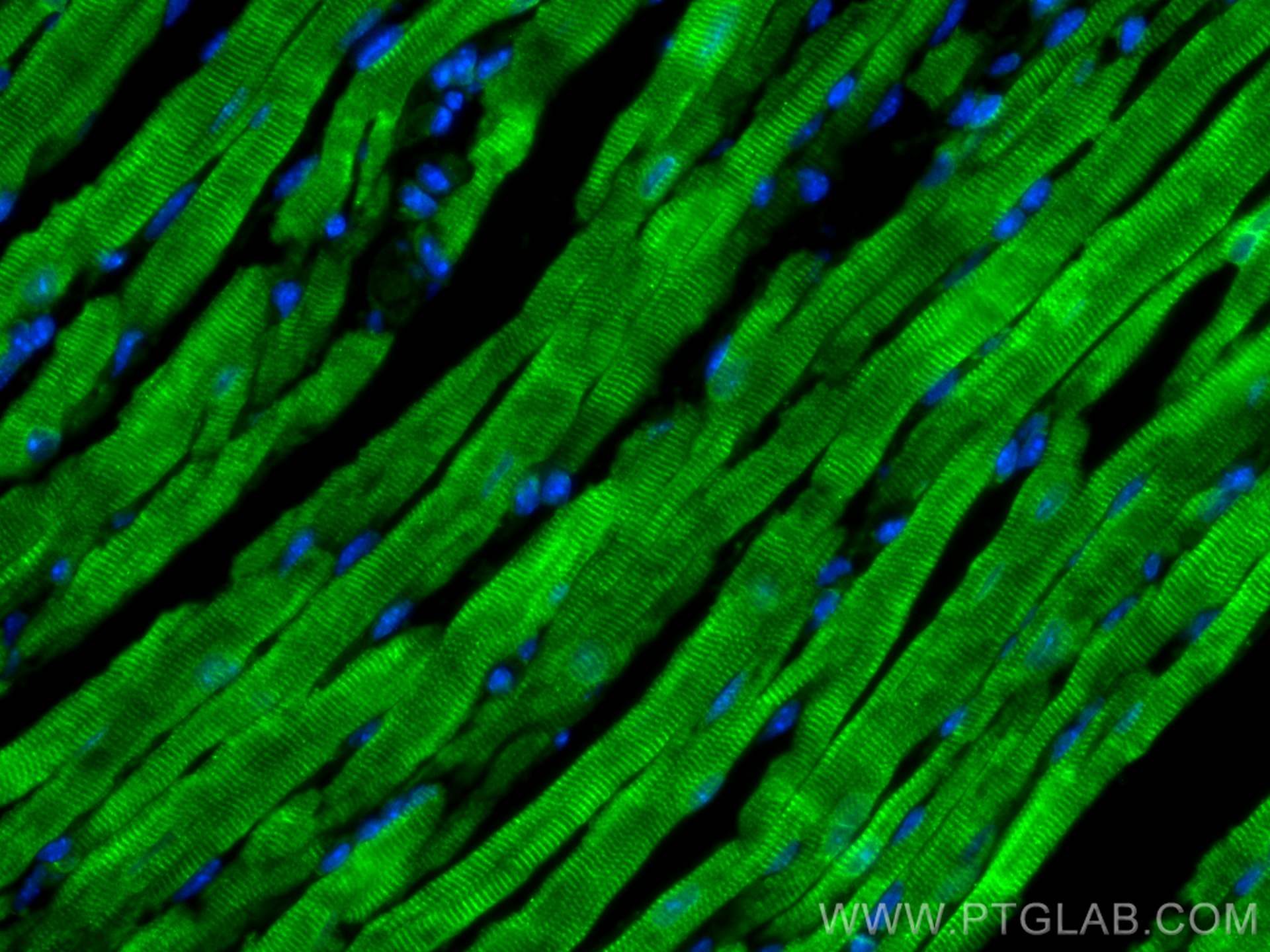 IF Staining of mouse heart using 22280-1-AP