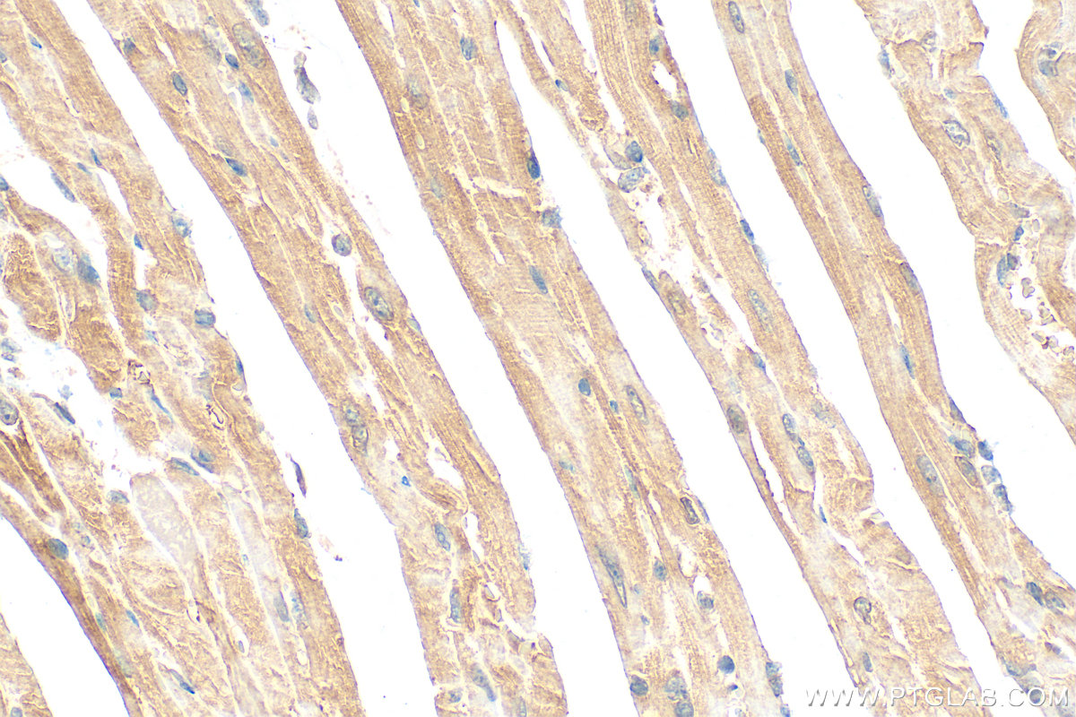 IHC staining of mouse heart using 22280-1-AP