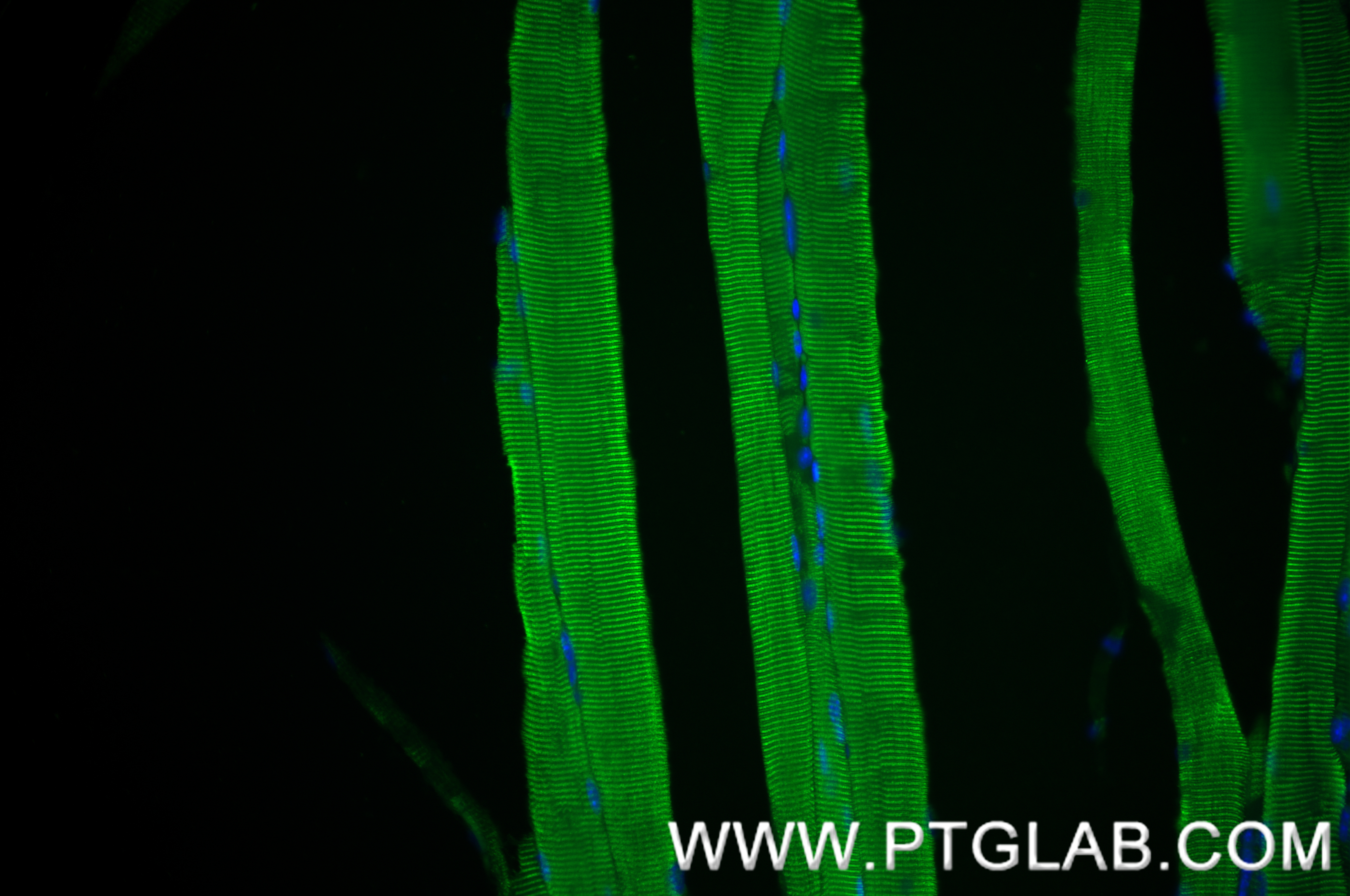 IF Staining of mouse skeletal muscle using 84594-1-RR (same clone as 84594-1-PBS)