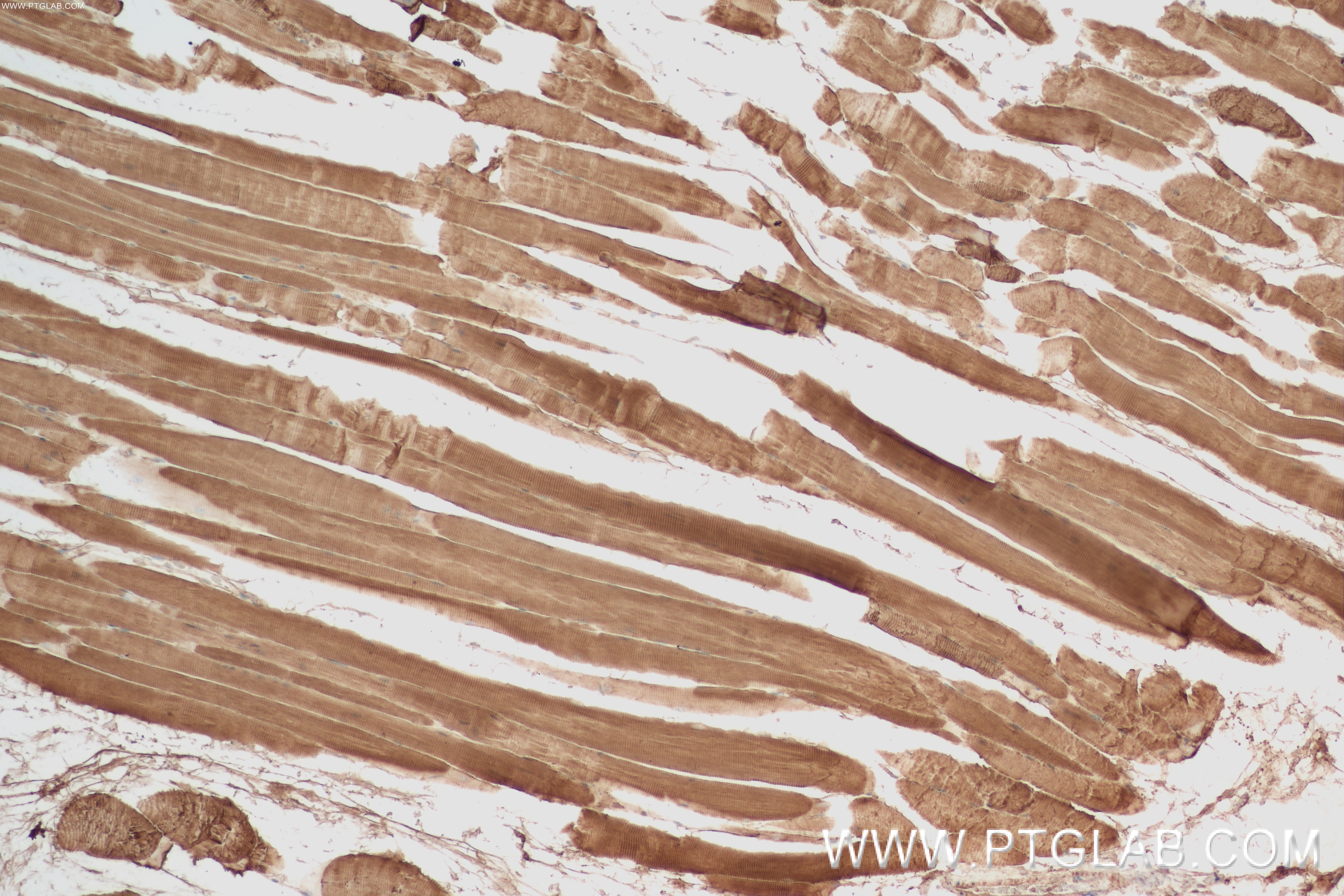 IHC staining of mouse skeletal muscle using 84594-1-RR (same clone as 84594-1-PBS)