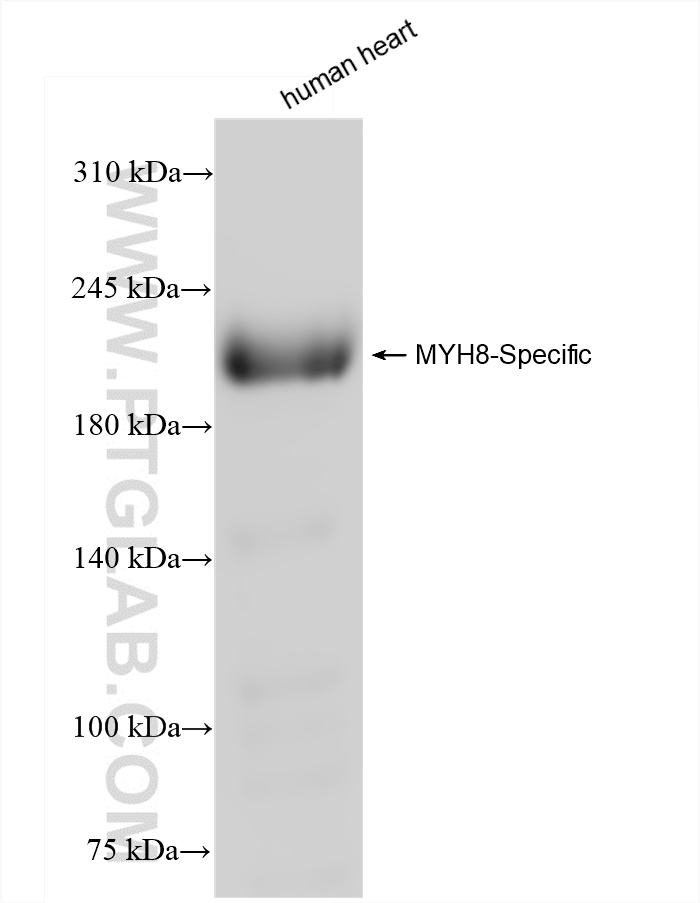 WB analysis of human heart using 84594-1-RR (same clone as 84594-1-PBS)