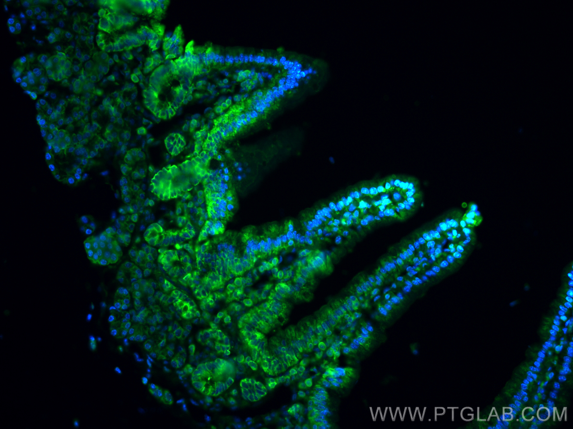 IF Staining of mouse small intestine using 11128-1-AP